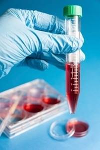 Откуда берут общий анализ крови у детей и у взрослых?