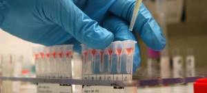 Расшифровка mpv в анализе крови: нормы и что делать если повышен?