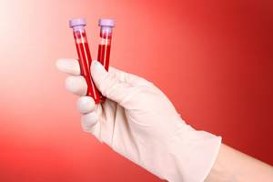 ГГТ в биохимическом анализе крови: что это такое?