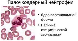 Палочкоядерные нейтрофилы: норма в крови, причины отклонения