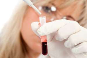 Анализ крови на глисты – как называется и как сдавать?