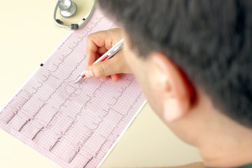 Что показывает ЭКГ сердца – видно ли на нем проблемы?