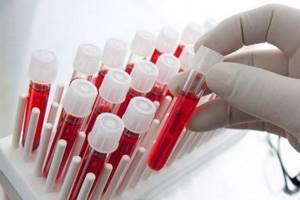 Анализ крови на биохимию: что показывает, расшифровка, нормы