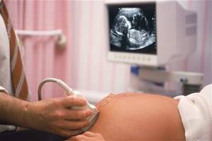 3 скрининг при беременности: сроки проведения, когда делать?