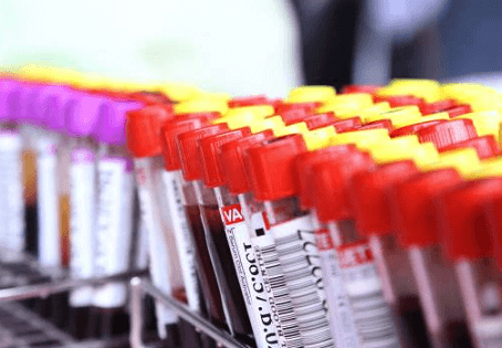 Расшифровка биохимического анализа крови у детей: таблица, нормы