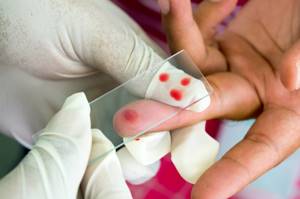Анализ крови на лямблии: расшифровка, как сдавать?