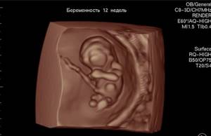 Фото УЗИ на 12 неделе беременности: пол ребенка, норма, расшифровка