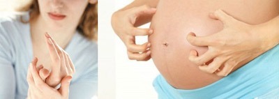Тромбоциты понижены при беременности: возможные причины, о чем это говорит?