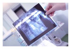 Компьютерная томография (КТ) грудной клетки и органов – что показывает?