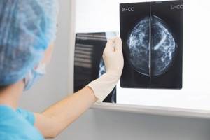 Как часто можно делать маммографию молочных желез?
