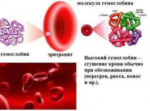 Повышенный гемоглобин у мужчин: причины, лечение, последствия