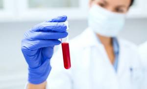rbc в анализе крови: расшифровка, норма