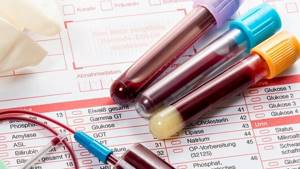 анализ крови на беременность на ранних сроках: как определить?