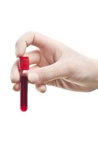 hbsag в анализе крови – что это за показатель?