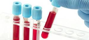 ПТИ в анализе крови – что это и каковы нормы?