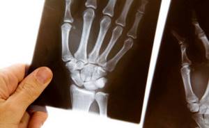 Рентген руки и кисти: фото, особенности
