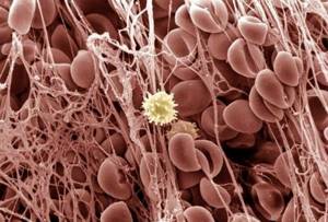 Норма фибриногена в крови у взрослых и детей