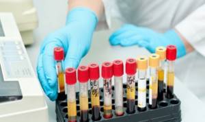 Анализ крови на гормоны: подготовка, расшифровка, как правильно сдавать?