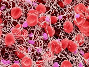 Норма тромбоцитов в крови у мужчин: таблица по возрастам, причины отклонения