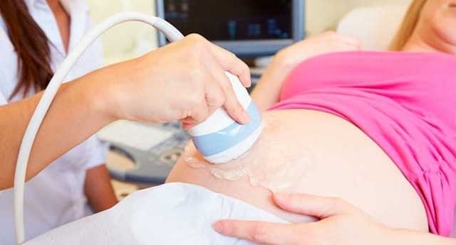 УЗИ лонного сочленения при беременности – как делают?