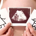 УЗИ при беременности: определение срока, что нужно знать?