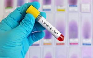 Анализ крови на витамины и микроэлементы
