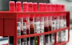 mid в анализе крови: расшифровка, нормальный уровень
