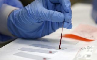 Покажет ли общий анализ крови ВИЧ?