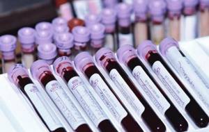 Гематологический анализ крови: расшифровка, нормальные показатели