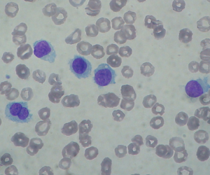 Лейкоциты в кале у взрослого: норма и отклонения
