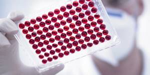 Серологический анализ крови: расшифровка, зачем его делают?