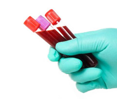 Микроцитоз в общем анализе крови – что это?