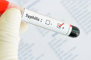Анализ крови на сифилис – как называется?