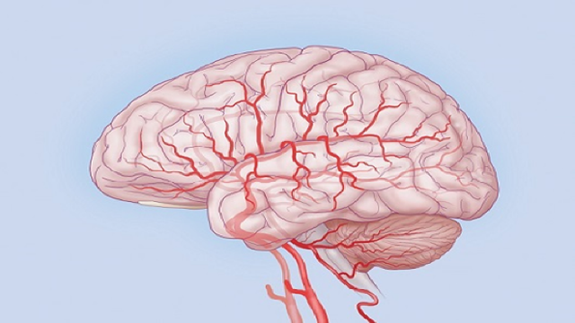 Транскраниальная допплерография сосудов головного мозга