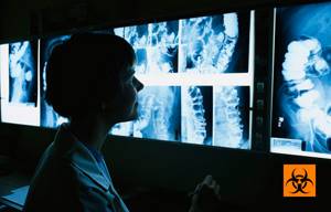 Как часто можно делать рентген ребенку и взрослому?