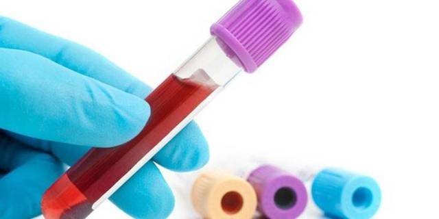 plt в анализе крови: расшифровка, норма для женщин и детей