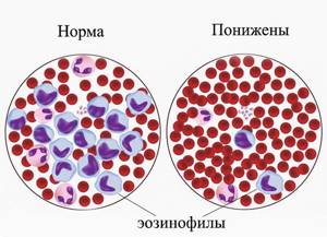 Эозинофилы в крови: как обозначаются в анализе, функции, норма
