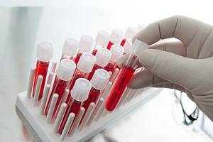 Что такое моноциты в анализе крови и что делать, если они повышены?Что такое моноциты в анализе крови и что делать, если они повышены?