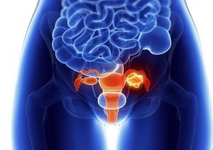 Трансабдоминальное УЗИ органов малого таза у женщин – как делают?