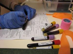 РЭА в анализе крови – что означает?