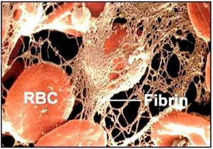 Фибриноген в крови: что это, норма и причины отклонения