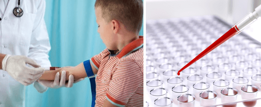 Расшифровка биохимического анализа крови у детей: таблица, нормы