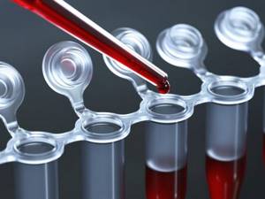 Анализ крови на антитела: виды, расшифровка