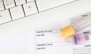 anti-hcv в анализе крови – что это?