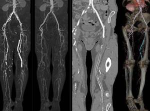 Рентген ноги: фото снимков, что видно?