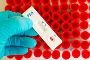 Анализ крови на ПСА: что означает, расшифровка, подготовка и нормы