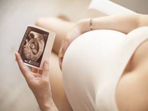 Фото УЗИ на 26 неделе беременности