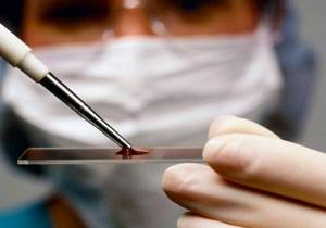 Чем отличается общий анализ крови от клинического?