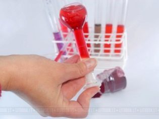 Анализ крови на ХГЧ: расшифровка результатов, когда сдавать?