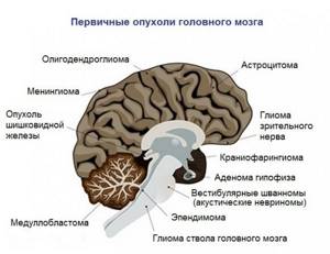 Что лучше КТ или МРТ головного мозга и чем они отличаются?
